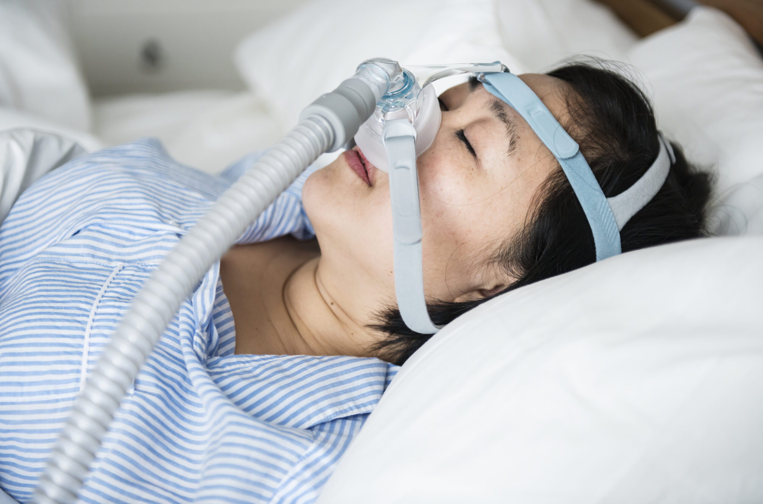 Obstructive sleep apnea